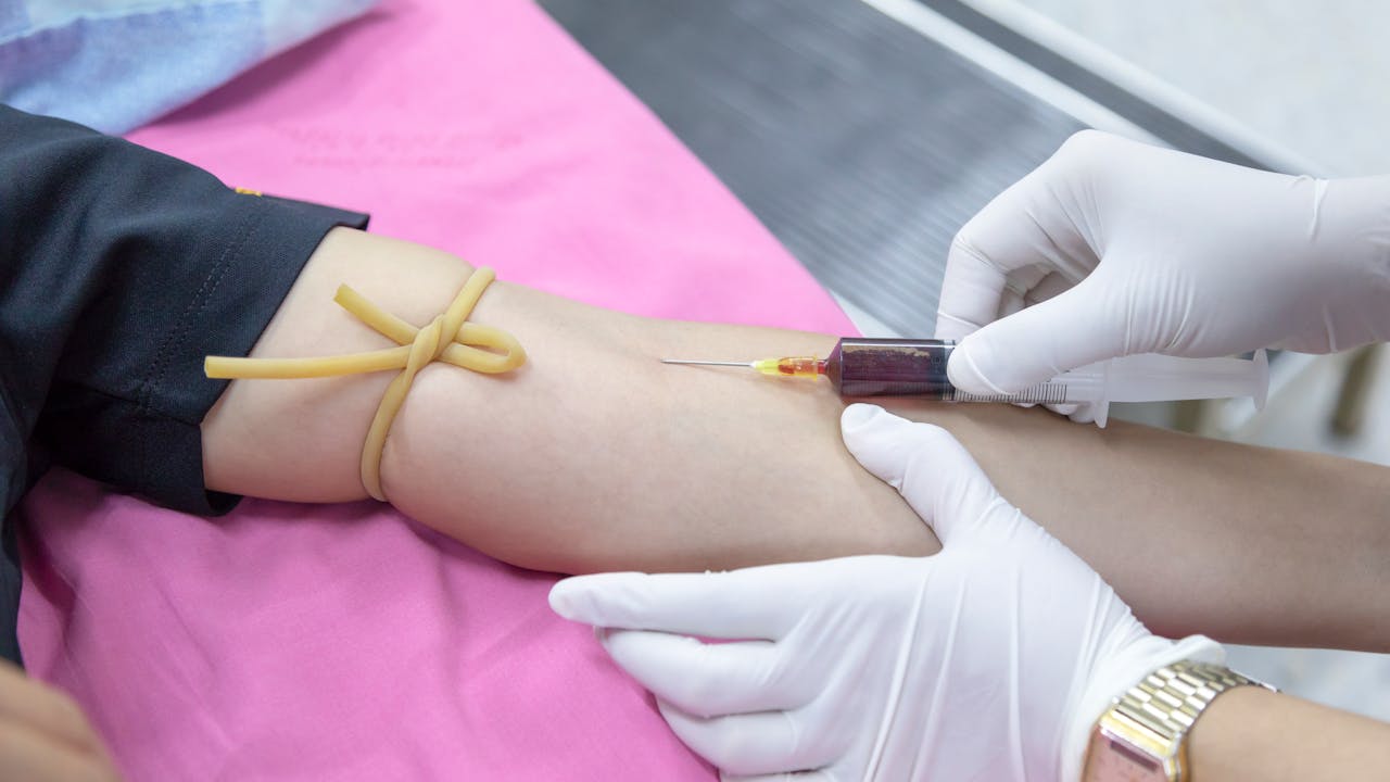 Subcutaneous injection technique showing correct skin pinch method for self-administration